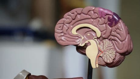 Apparently Covid Aged All Our Brains, Even If You Didn't Catch It