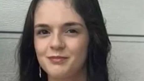 Teen girl viciously mauled by friend's dog and left fighting for her life