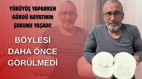 Yürüyüşe çıktı, hayatının şokuyla karşılaştı! Tam 2.5 kilo ağırlığında: Böylesi ilk kez görüldü