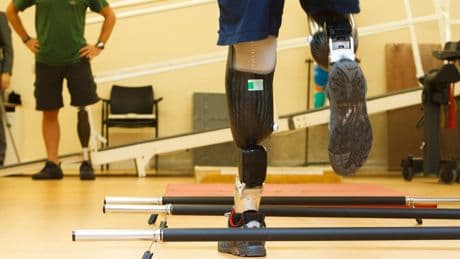 New software could reduce NHS waiting lists for prosthetic legs, study finds