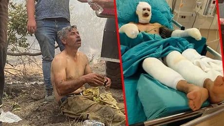 'Yanıyorum' diye feryat etmişti: Kahraman orman işçisinden haber var