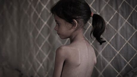 Die Mathematik des Aushungerns: Wie Israel eine Hungersnot in Gaza verursachte