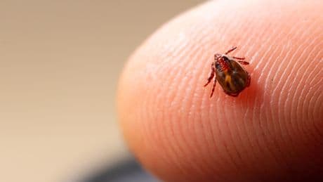 Quebec reports first case of tick-borne Rocky Mountain spotted fever