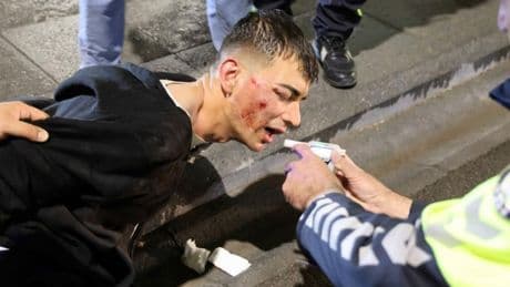Yasal sınırın 9 kat üzeri alkol alan sürücünün "dişim ağrıyor" feryadı