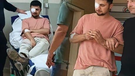 Ahşaptan fırlayan çivi gözüne saplandı: Görme yetisini kaybetti