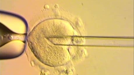 Three-parent babies born using pioneering IVF treatment to prevent hereditary disease