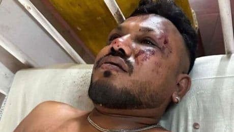 New video shows British survivor walking away from Air India crash as fireball erupts