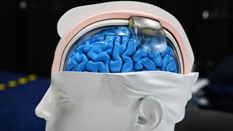 The brain tech revolution is here — and it isn’t all Black Mirror