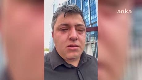 Altındağ Belediyesi işçisini darbeden zabıta müdürü tutuklandı