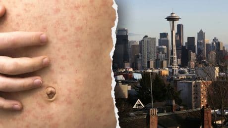 Officials in West Coast state sound alarm after traveler diagnosed with highly contagious viral disease