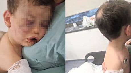 Denizli'de korkunç olay! 2 yaşındaki çocuk, annesinin erkek arkadaşı tarafından dövüldü