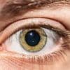 The subtle clue in your EYE that could mean you'll get dementia as young as 45