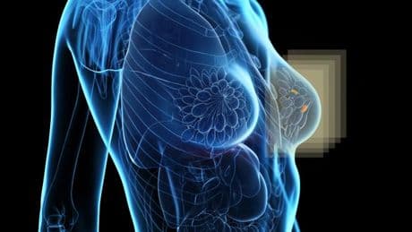 Breast cancer breakthrough as new super-fast scanner unveiled