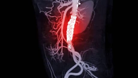 Ni el hígado ni los pulmones: China estudia el cuerpo humano y descubre qué órgano envejece primero