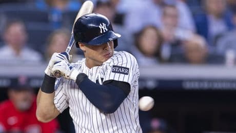Yankees play it safe with Anthony Volpe lineup decision one day after hit by pitch