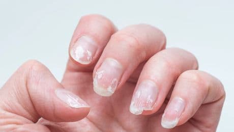 Adiós uñas escamadas: cómo recuperar su aspecto saludable tras las manicuras del verano