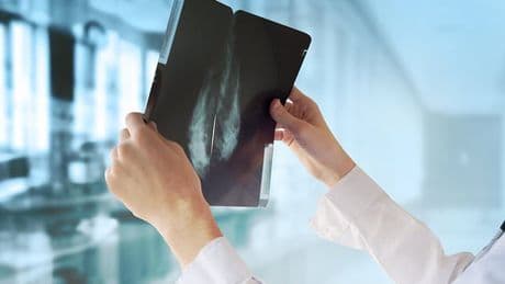 AI set to offer women 'two for one' heart and breast screening