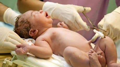 El Supremo concede una indemnización millonaria por las lesiones neurológicas irreversibles que sufrió un niño en el parto