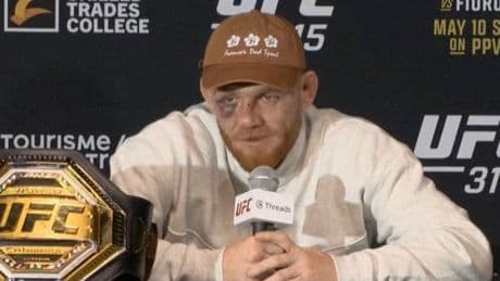 UFC champion left with bad injuries despite huge win in title fight