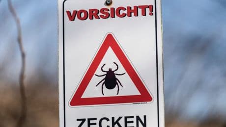 Sachsen: Borreliosefälle steigen um 47 Prozent – Das rät eine Expertin