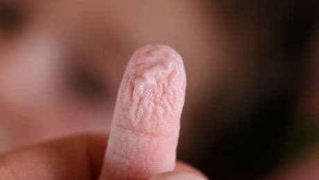 Pourquoi nous avons les doigts fripés dans l’eau, et comment ils pourraient marquer notre identité