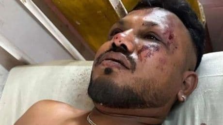 Air India crash: Brit passenger SURVIVES horror fireball that killed hundreds