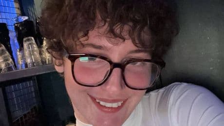 'Reaction to fillers made me look like an alien - comments were cruel'