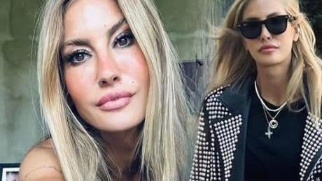 Çağla Şıkel'in bacakları mosmor oldu! Nedeni ise yeni hobisi: En güzel yaz