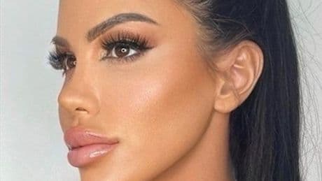 'I spent £450,000 trying to fix my face as plastic surgery left me unrecognisable'