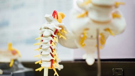 Une thérapie cellulaire révolutionnaire capable de réparer la moelle épinière entre en phase d'essai clinique