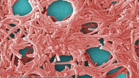 Preocupación en Getxo: un caso de legionella obliga a desinfectar 300 viviendas en una urbanización