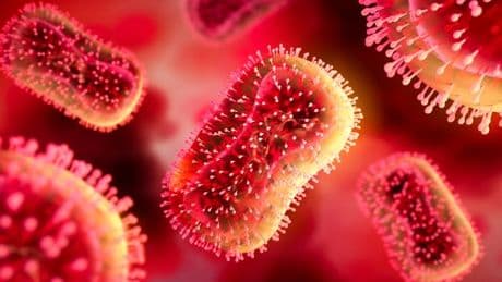 UK hospital urgently tracing anyone in contact with A&E patient with rare virus