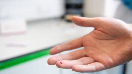 At-home hepatitis C test identifies hundreds with silent but deadly virus