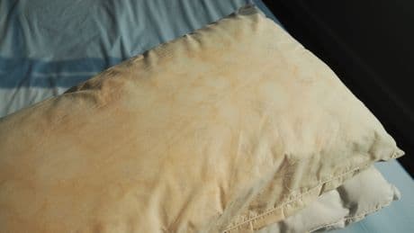 Gelbe Flecken auf dem Kissen? Nicht nur eklig - auch eine echte Gefahr