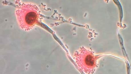 Killer fungus forecast to spread to UK