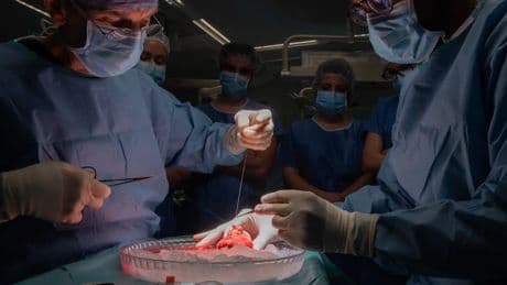 Hito médico: realizan el primer trasplante de pulmón de cerdo a un humano que estaba en muerte cerebral