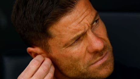 Xabi Alonso’nun Real Madrid’indeki 5 baş ağrısı