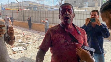 Mueren cuatro periodistas, entre ellos uno de Reuters y otro de Al Jazeera, tras un ataque israelí al hospital Nasser en Gaza