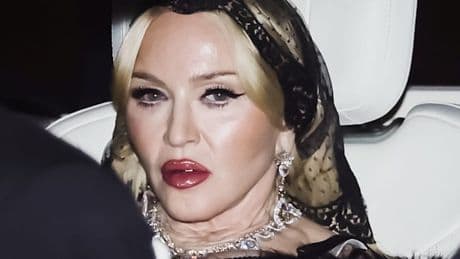 Das Madonna-Syndrom