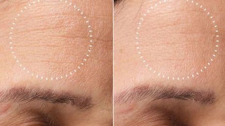 Save hundreds on salon chemical peel treatments with Medik8’s on-sale at-home alternative