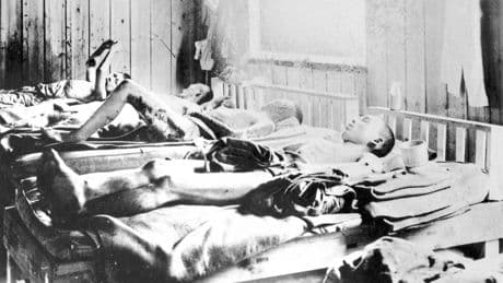 Atombombenabwürfe | 80 Jahre Hiroshima: Überlebende als Forschungsobjekte