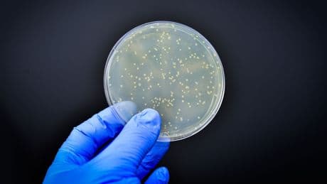 Más del 70% de los genes de resistencia a antibióticos están presentes en la cadena alimentaria