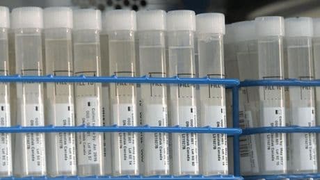 La creadora de la firma de test genéticos 23andMe recompra la empresa tras sobrepujar a la biotecnológica Regeneron