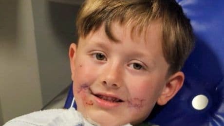 Boy, 4, left with ‘horror film’ injuries after Bully dog attack