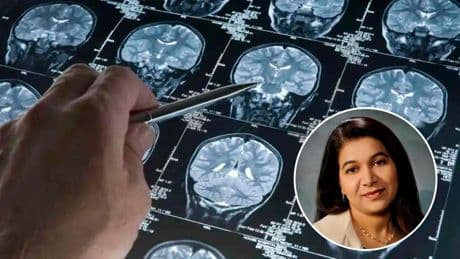 Soy neuróloga vascular y estos son los ocho síntomas de accidente cerebrovascular que más se ignoran en las mujeres
