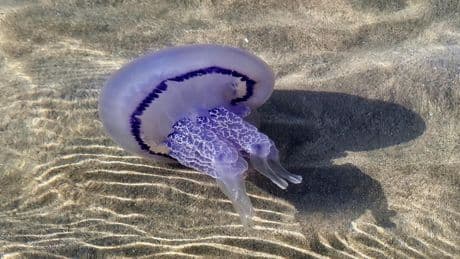 ¿Qué hacer si te pica la megamedusa?