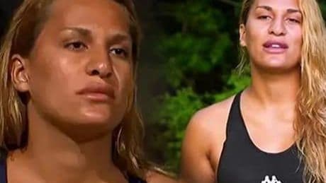 Survivor Almeda Baylan estetikli halini paylaştı! İşte son hali