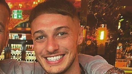 Teacher obsessed with baldness killed himself after using unlicensed hair loss drug