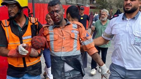 Four Journalists Among Those Killed in Israeli Strikes on Gaza Hospital, Officials Say