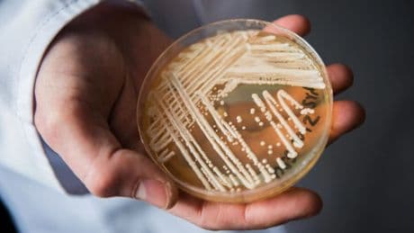 Super fungo farmacoresistente dilaga in Europa: l’Italia è terza per numero di casi